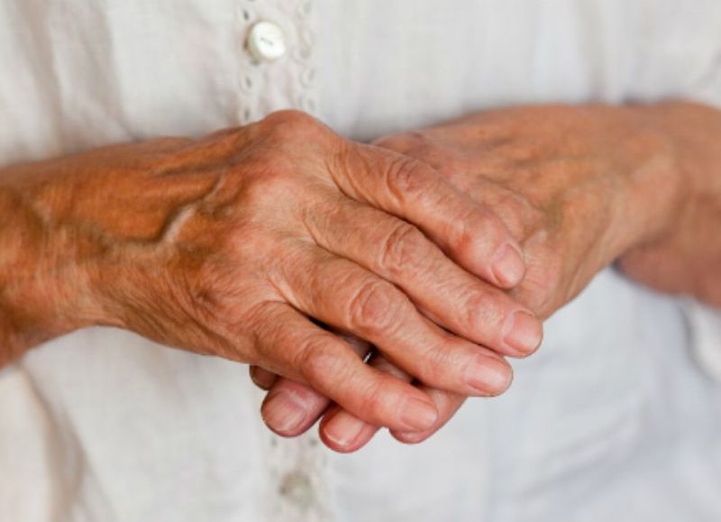 Artritis reumatoidea: la importancia de un diagnóstico temprano
