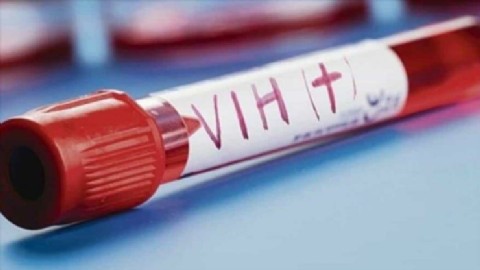 Nueva variante del VIH altamente contagiosa y virulenta es descubierta