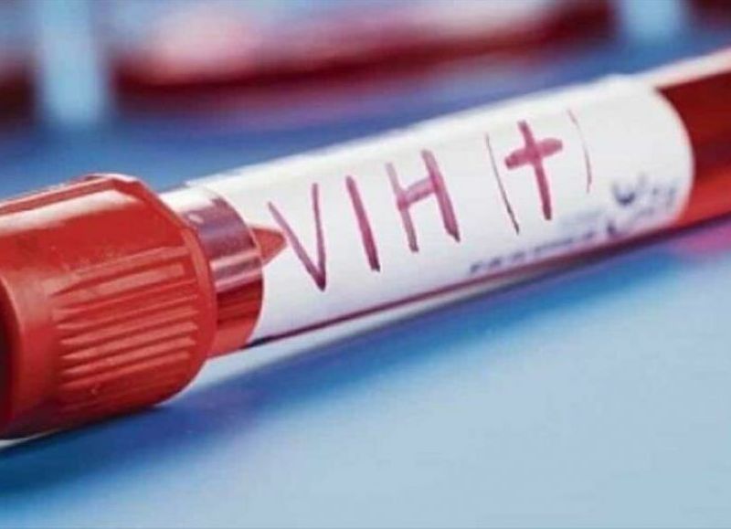 Nueva variante del VIH altamente contagiosa y virulenta es descubierta
